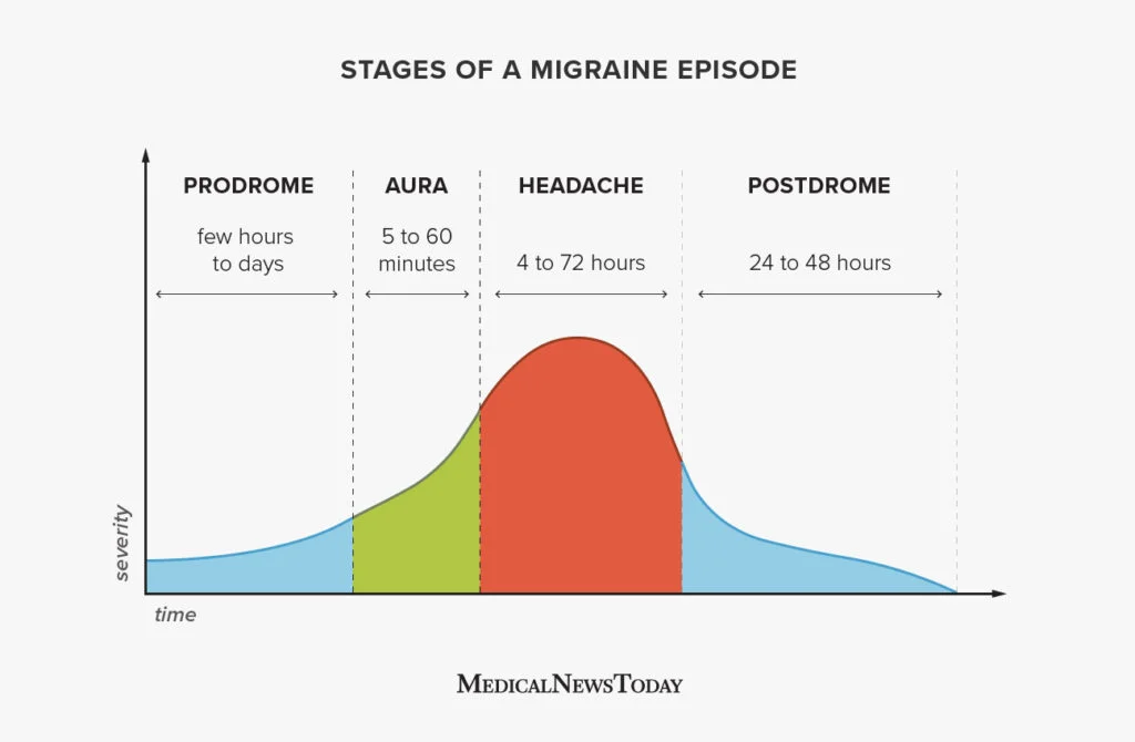 migraine timeline 1296x848 body 1024x670 1