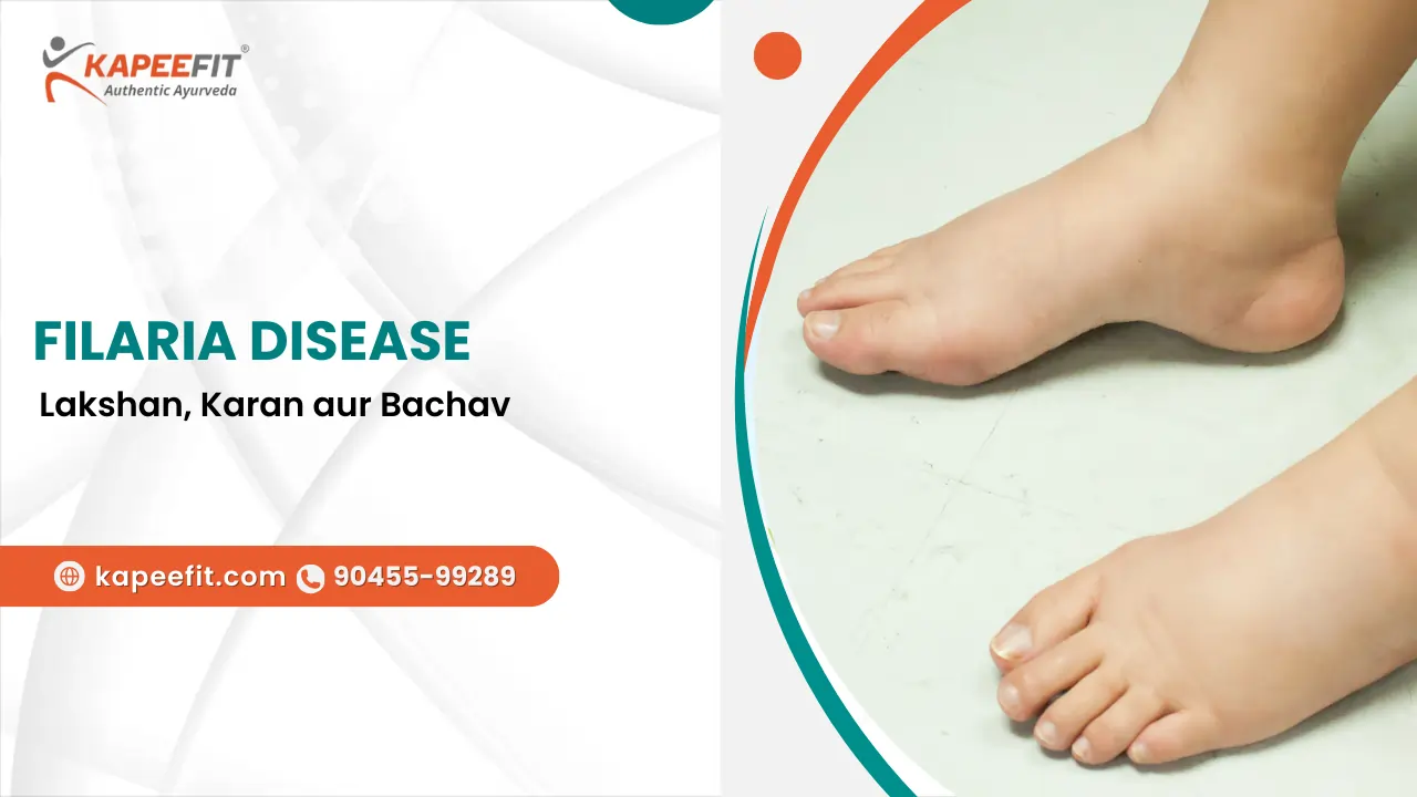 Filaria Disease