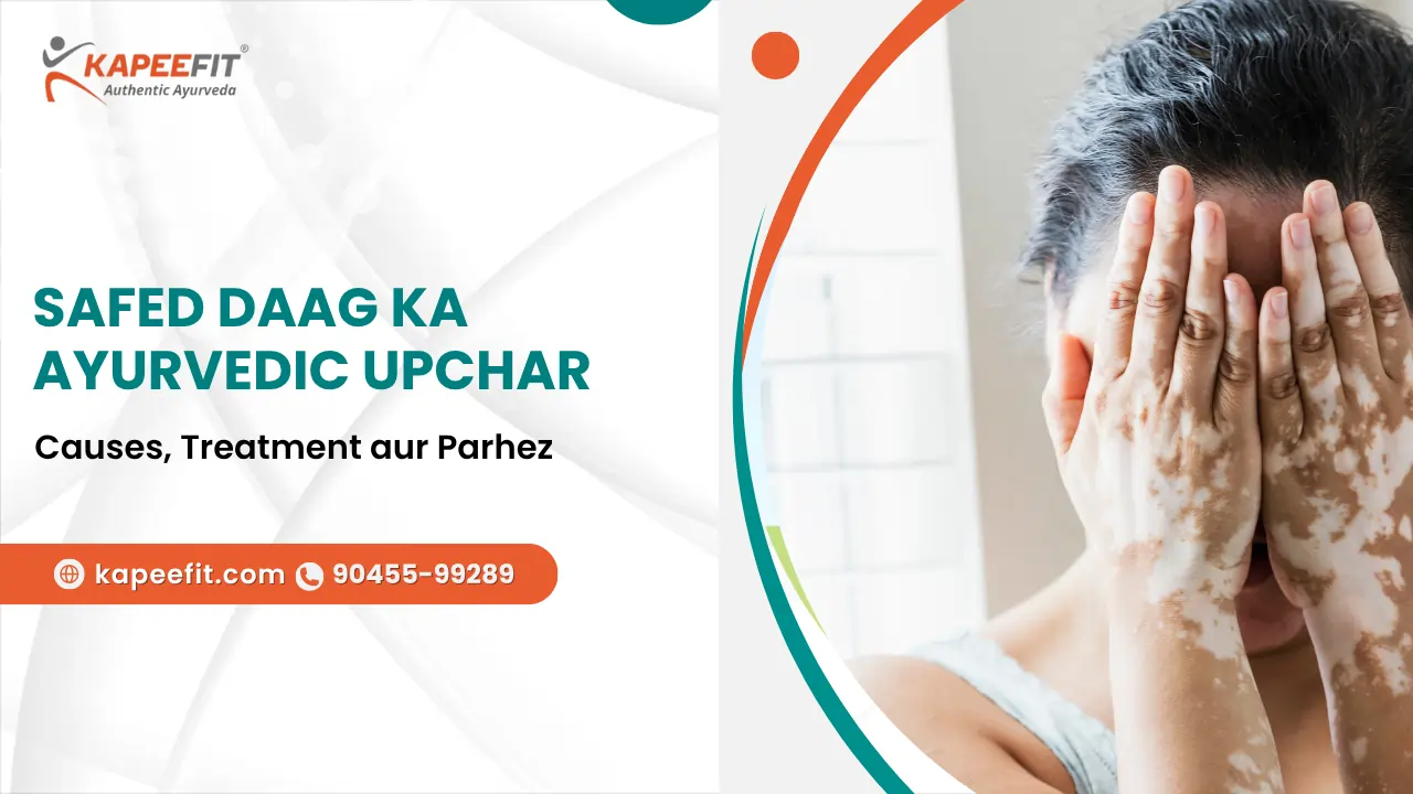 Safed Daag ka Ayurvedic Upchar