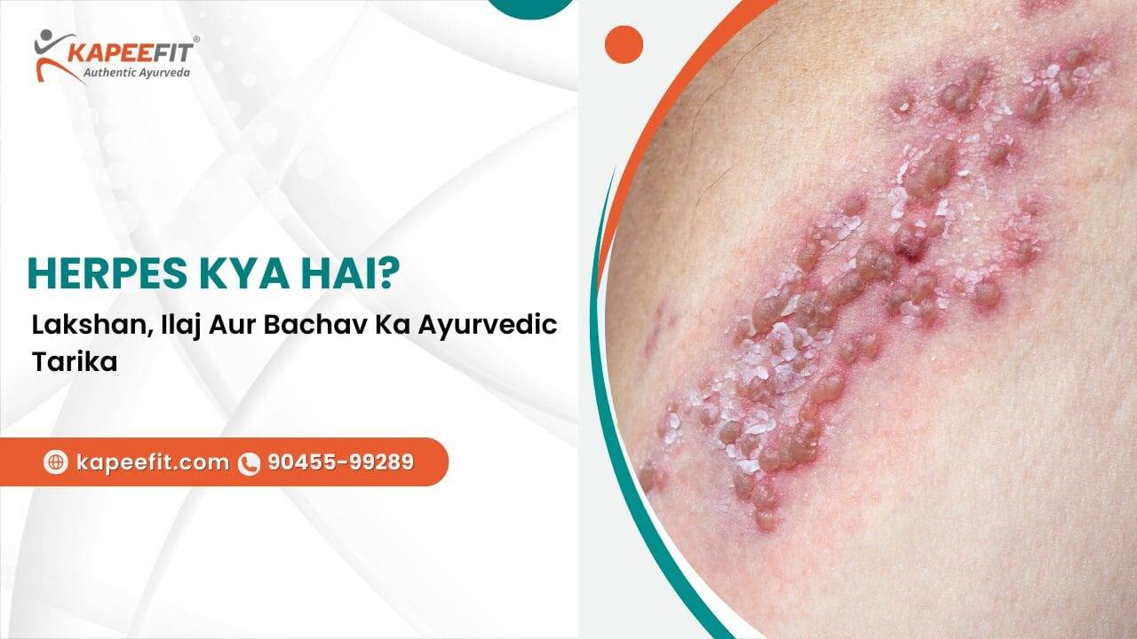 Herpes Kya Hai