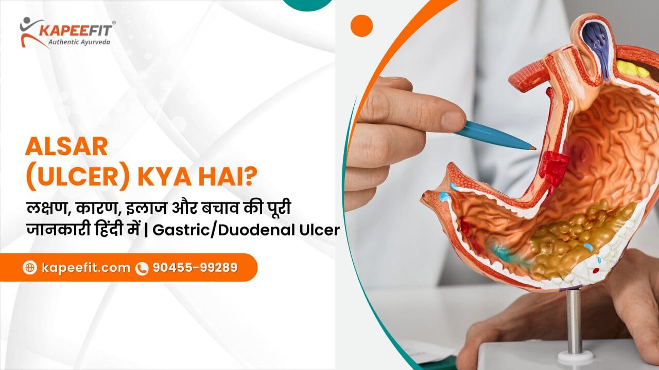 Alsar (Ulcer) Kya Hai