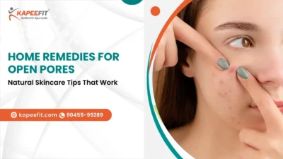 Kapeefit - Ayurvedic Products & Online Consultation 46 Home Remedies for Open Pores