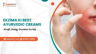 Ekzima Ki Best Ayurvedic Creams