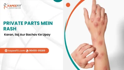 Private Parts Mein Rash