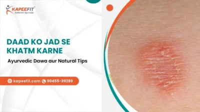 Kapeefit - Ayurvedic Products & Online Consultation 51 Daad Ko Jad Se Khatm Karne