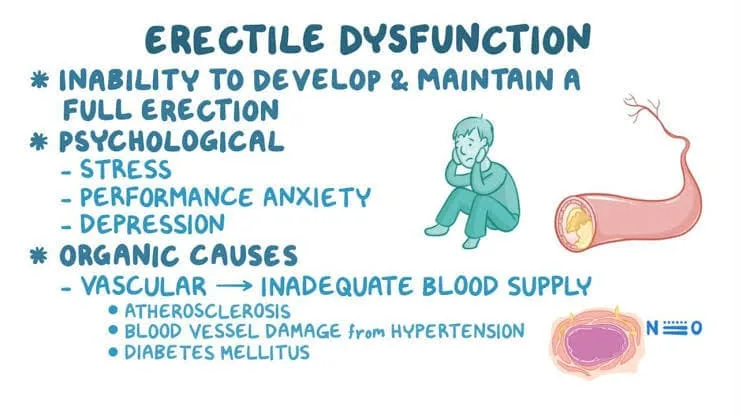 Understanding Erectile Dysfunction